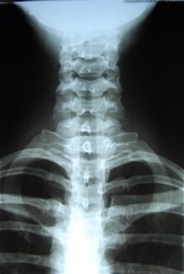 digital x-ray
